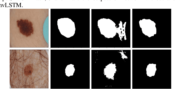 Figure 3 for Multi-level Context Gating of Embedded Collective Knowledge for Medical Image Segmentation