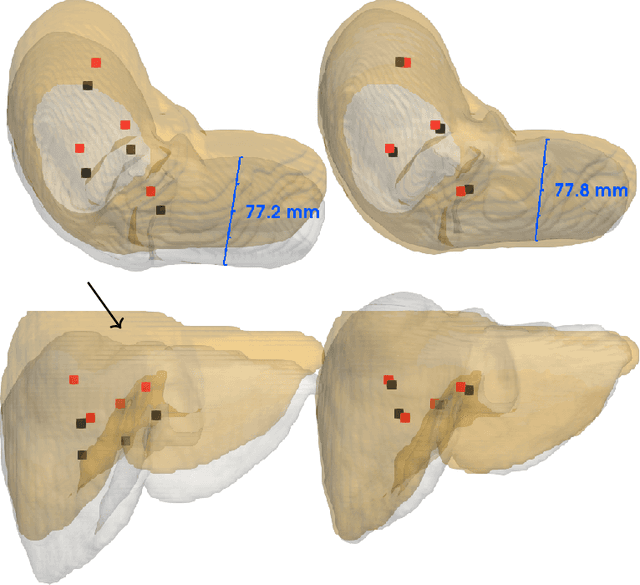 Figure 3 for Non-Rigid Volume to Surface Registration using a Data-Driven Biomechanical Model