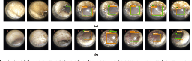 Figure 4 for Pediatric Otoscopy Video Screening with Shift Contrastive Anomaly Detection