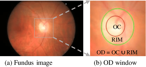 Figure 1 for A Deep Gradient Boosting Network for Optic Disc and Cup Segmentation