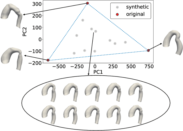 Figure 3 for Deep learning-based surrogate model for 3-D patient-specific computational fluid dynamics