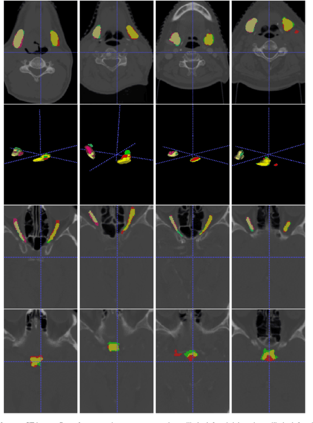 Figure 4 for AnatomyNet: Deep 3D Squeeze-and-excitation U-Nets for fast and fully automated whole-volume anatomical segmentation
