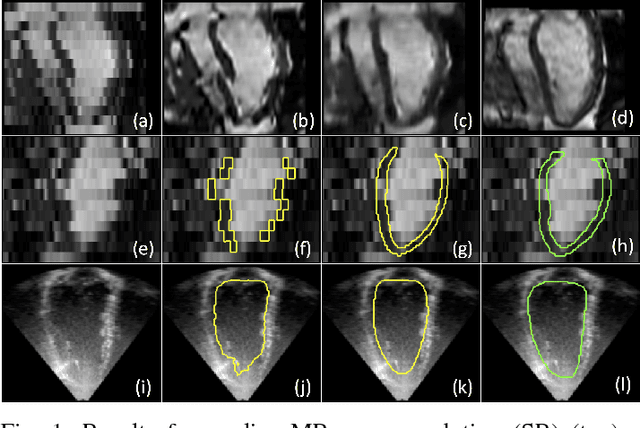 Figure 1 for Anatomically Constrained Neural Networks (ACNN): Application to Cardiac Image Enhancement and Segmentation