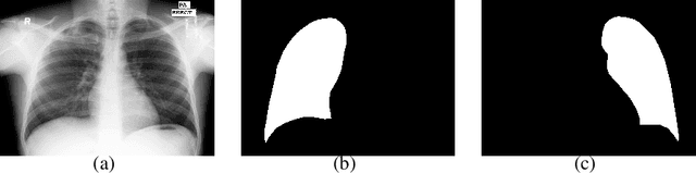 Figure 1 for Towards Robust Lung Segmentation in Chest Radiographs with Deep Learning