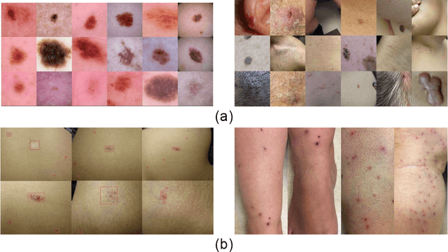 Figure 1 for DermGAN: Synthetic Generation of Clinical Skin Images with Pathology