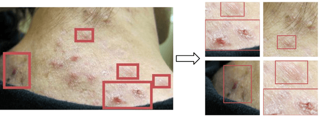 Figure 3 for DermGAN: Synthetic Generation of Clinical Skin Images with Pathology