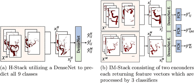 Figure 4 for Building Brains: Subvolume Recombination for Data Augmentation in Large Vessel Occlusion Detection