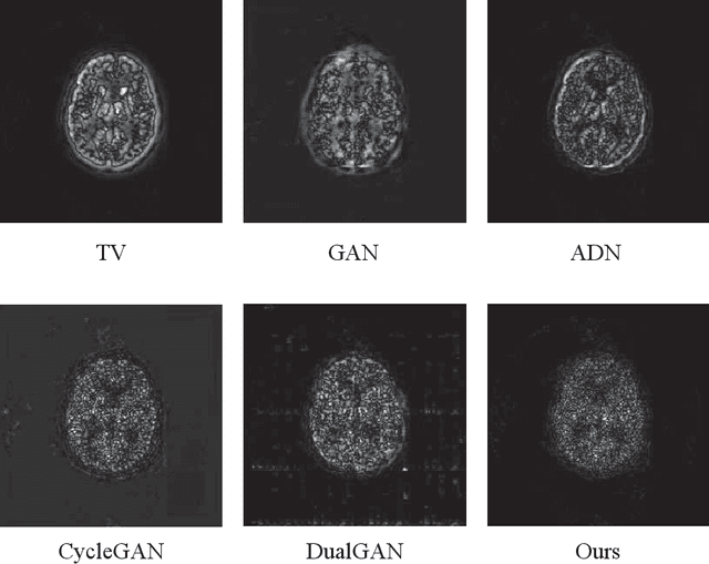Figure 3 for Quasi-supervised Learning for Super-resolution PET
