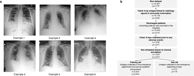 Figure 3 for An artificial intelligence system for predicting the deterioration of COVID-19 patients in the emergency department