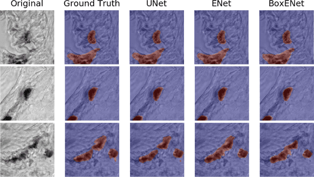 Figure 4 for Comparison of UNet, ENet, and BoxENet for Segmentation of Mast Cells in Scans of Histological Slices