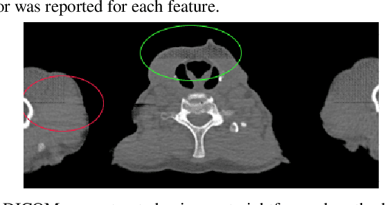 Figure 2 for STAN-CT: Standardizing CT Image using Generative Adversarial Network