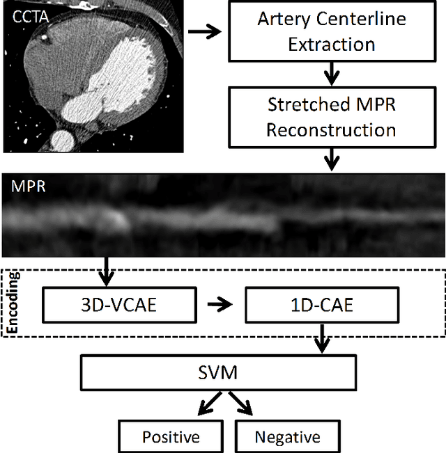 Figure 1 for Deep learning analysis of cardiac CT angiography for detection of coronary arteries with functionally significant stenosis