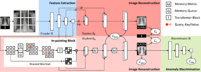 Figure 3 for In-painting Radiography Images for Unsupervised Anomaly Detection