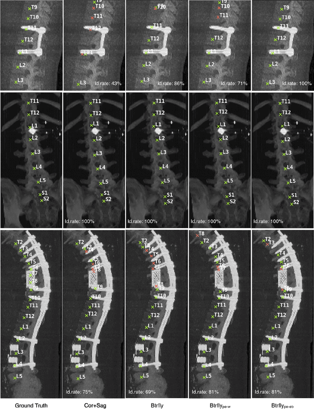 Figure 4 for Adversarially Learning a Local Anatomical Prior: Vertebrae Labelling with 2D reformations