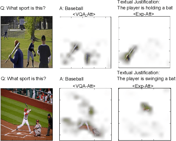 Figure 1 for Attentive Explanations: Justifying Decisions and Pointing to the Evidence (Extended Abstract)