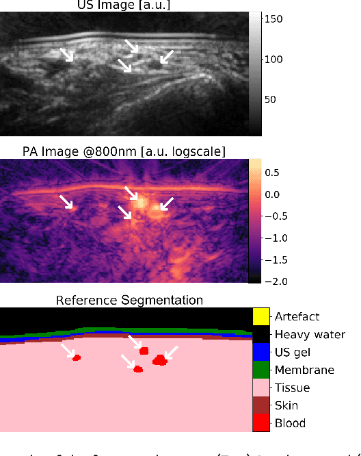 Figure 3 for Semantic segmentation of multispectral photoacoustic images using deep learning