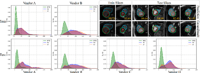 Figure 1 for Style Curriculum Learning for Robust Medical Image Segmentation