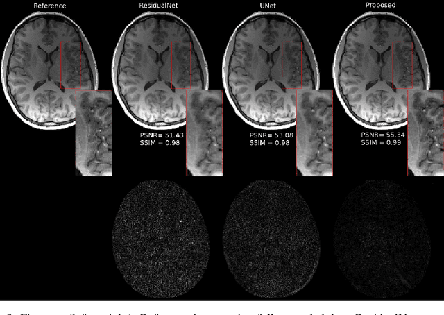 Figure 2 for ODE-based Deep Network for MRI Reconstruction