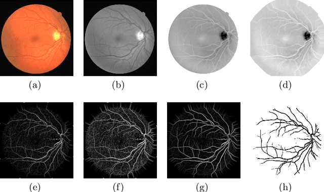 Figure 3 for Application of Top-hat Transformation for Enhanced Blood Vessel Extraction