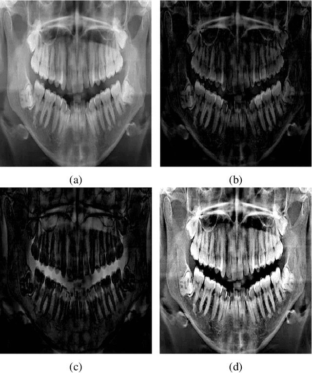 Figure 1 for Contrast Enhancement of Medical X-Ray Image Using Morphological Operators with Optimal Structuring Element