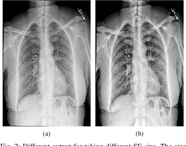 Figure 2 for Contrast Enhancement of Medical X-Ray Image Using Morphological Operators with Optimal Structuring Element
