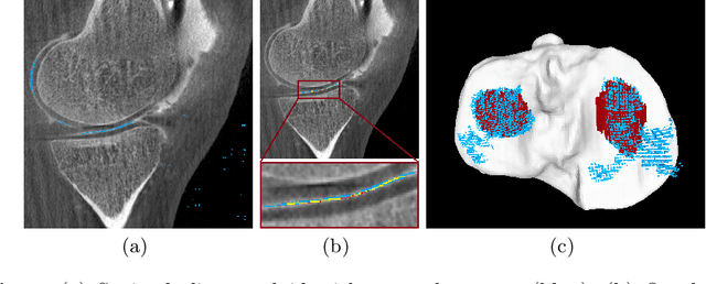 Figure 3 for Multi-Channel Volumetric Neural Network for Knee Cartilage Segmentation in Cone-beam CT