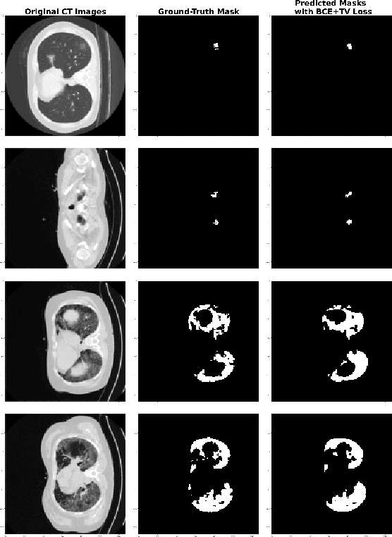 Figure 1 for COVID TV-UNet: Segmenting COVID-19 Chest CT Images Using Connectivity Imposed U-Net