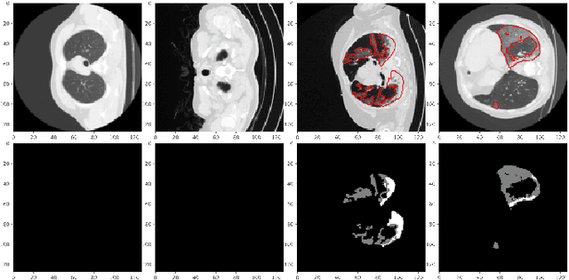 Figure 4 for COVID TV-UNet: Segmenting COVID-19 Chest CT Images Using Connectivity Imposed U-Net