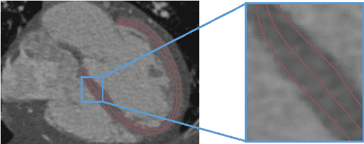 Figure 1 for Fast Segmentation of Left Ventricle in CT Images by Explicit Shape Regression using Random Pixel Difference Features