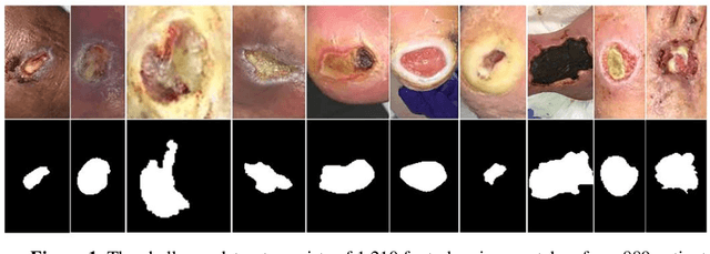 Figure 1 for FUSeg: The Foot Ulcer Segmentation Challenge