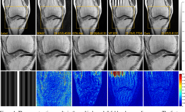 Figure 1 for High-Frequency Space Diffusion Models for Accelerated MRI