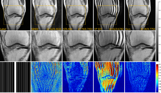 Figure 2 for High-Frequency Space Diffusion Models for Accelerated MRI