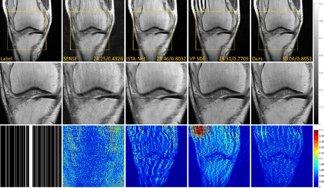 Figure 4 for High-Frequency Space Diffusion Models for Accelerated MRI