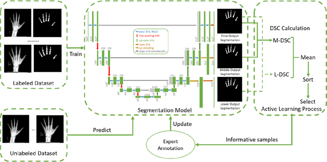 Figure 1 for Deeply Supervised Active Learning for Finger Bones Segmentation