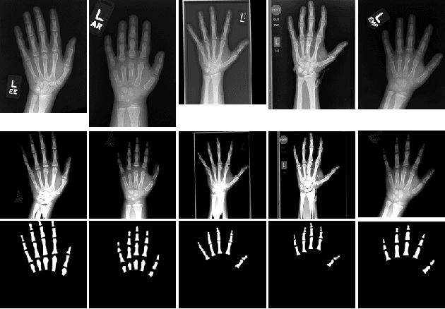 Figure 2 for Deeply Supervised Active Learning for Finger Bones Segmentation