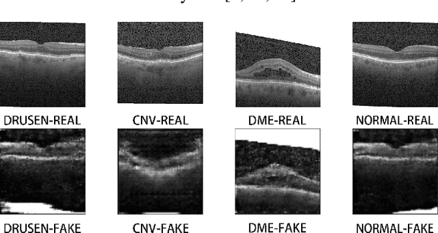 Figure 1 for Weakly-supervised Generative Adversarial Networks for medical image classification