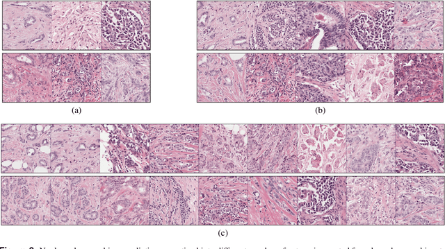 Figure 3 for Automated Scoring of Nuclear Pleomorphism Spectrum with Pathologist-level Performance in Breast Cancer