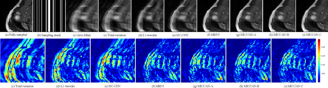 Figure 3 for MRI Reconstruction via Cascaded Channel-wise Attention Network