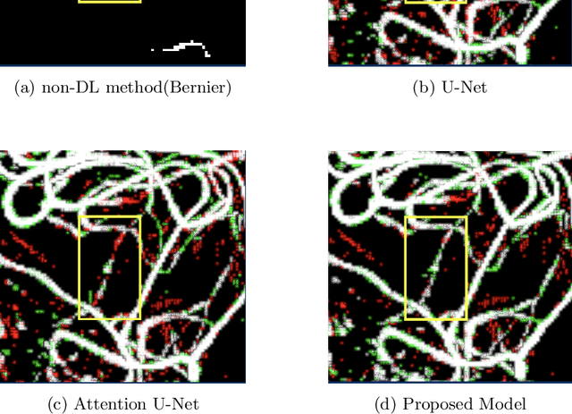 Figure 3 for DS6: Deformation-aware learning for small vessel segmentation with small, imperfectly labeled dataset
