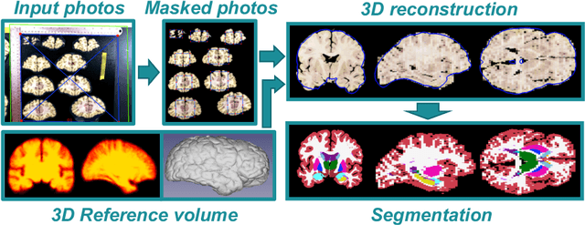Figure 1 for 3D Reconstruction and Segmentation of Dissection Photographs for MRI-free Neuropathology