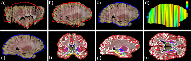 Figure 3 for 3D Reconstruction and Segmentation of Dissection Photographs for MRI-free Neuropathology