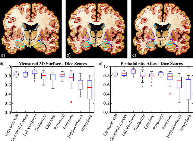 Figure 4 for 3D Reconstruction and Segmentation of Dissection Photographs for MRI-free Neuropathology
