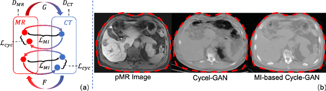 Figure 4 for Synthesis and Inpainting-Based MR-CT Registration for Image-Guided Thermal Ablation of Liver Tumors