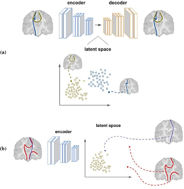 Figure 3 for Tractography filtering using autoencoders