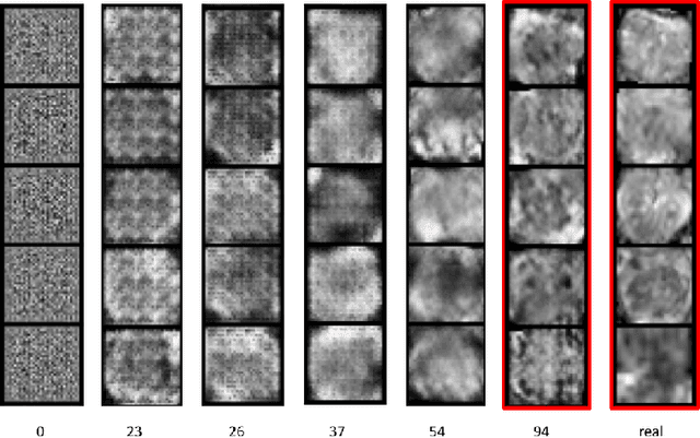 Figure 2 for ProstateGAN: Mitigating Data Bias via Prostate Diffusion Imaging Synthesis with Generative Adversarial Networks