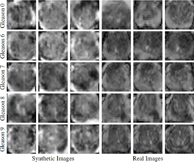 Figure 3 for ProstateGAN: Mitigating Data Bias via Prostate Diffusion Imaging Synthesis with Generative Adversarial Networks