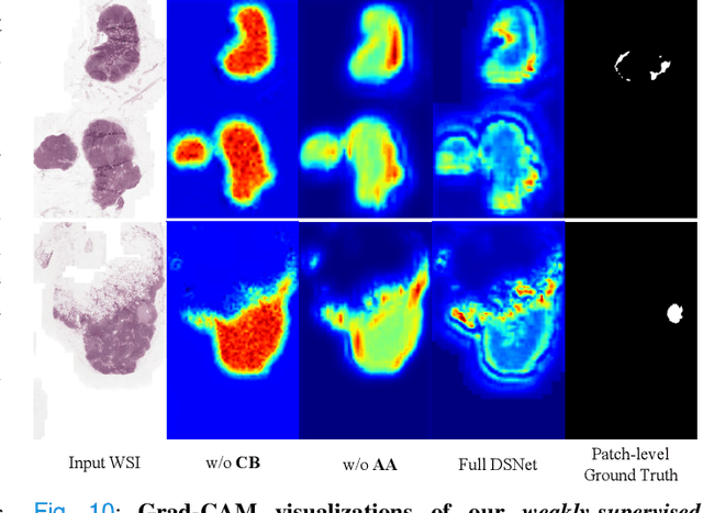 Figure 2 for DSNet: A Dual-Stream Framework for Weakly-Supervised Gigapixel Pathology Image Analysis