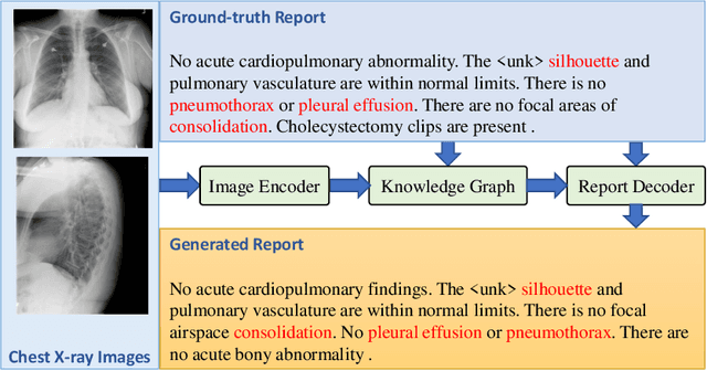 Figure 1 for Prior Knowledge Enhances Radiology Report Generation