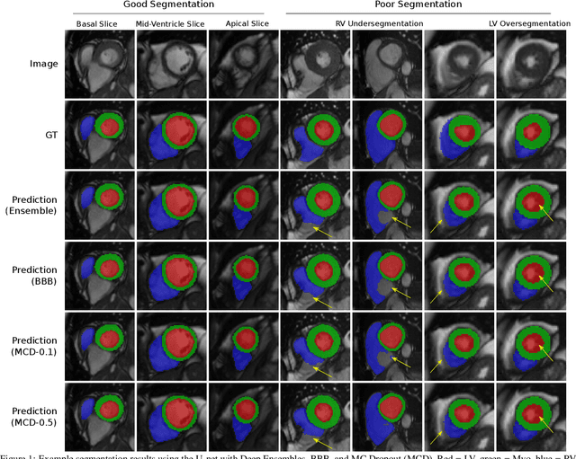 Figure 2 for Estimating Uncertainty in Neural Networks for Cardiac MRI Segmentation: A Benchmark Study