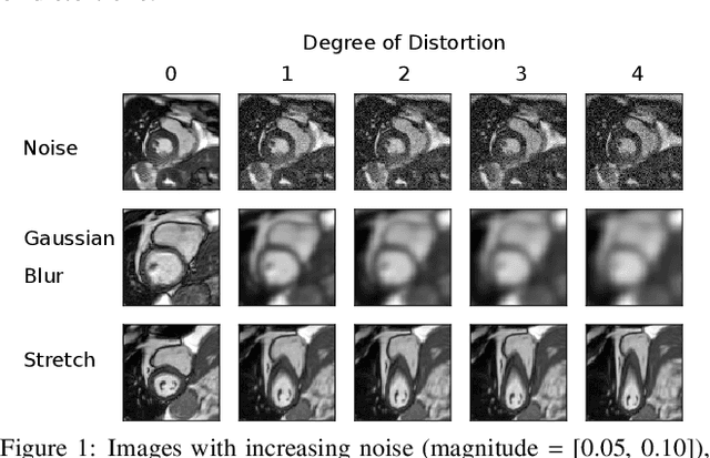 Figure 1 for Estimating Uncertainty in Neural Networks for Cardiac MRI Segmentation: A Benchmark Study